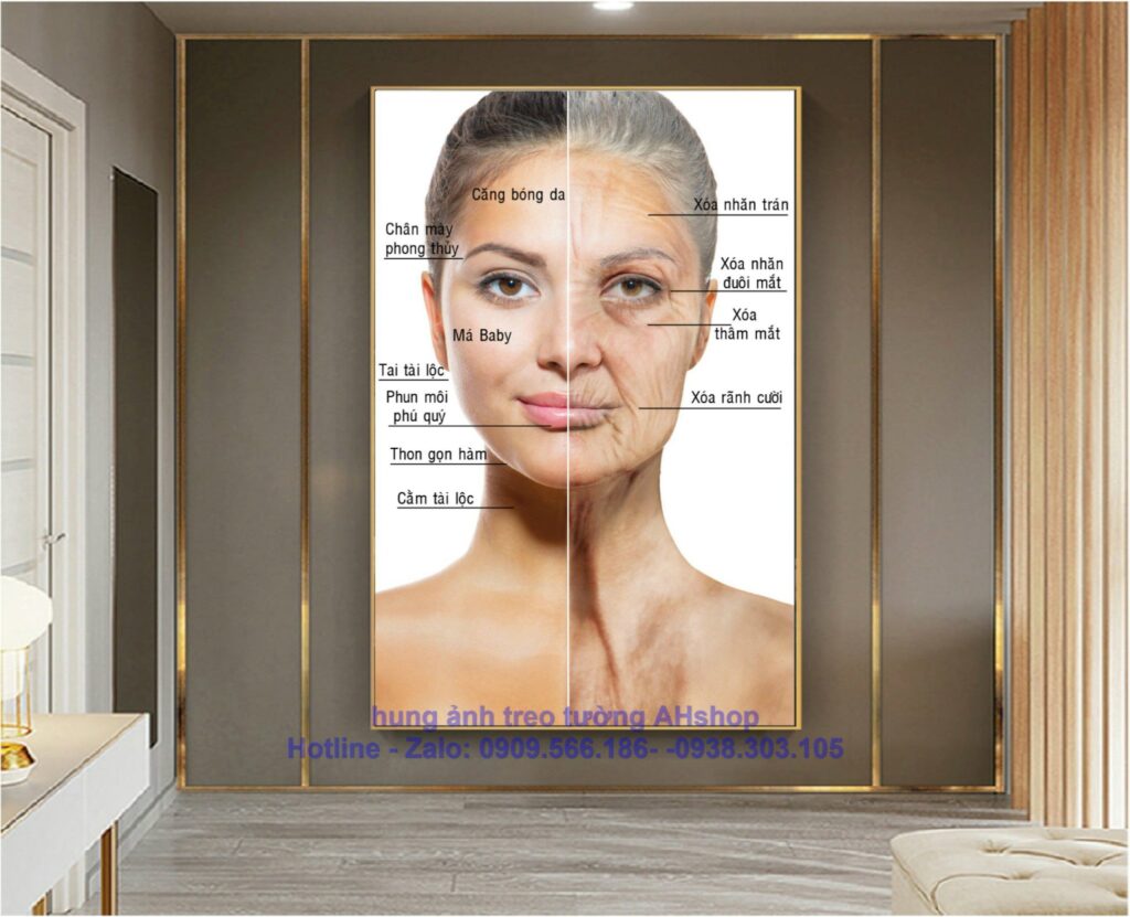 tranh-tiem-filler-botox