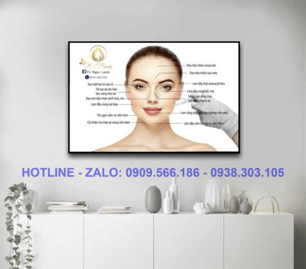 tranh-tiem-filler-botox