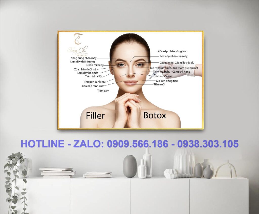 tranh-tiem-fiiler-botox