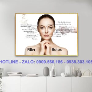 Tranh tiêm Filler Botox